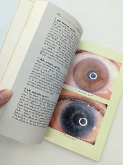 Eyes Talk Through Iridology to Better Health John Vriend 1989 Natural Therapy by John Vriend